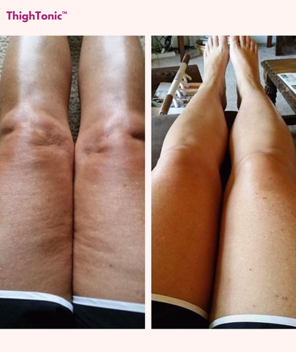 ThighTonic™ Thigh Trainer